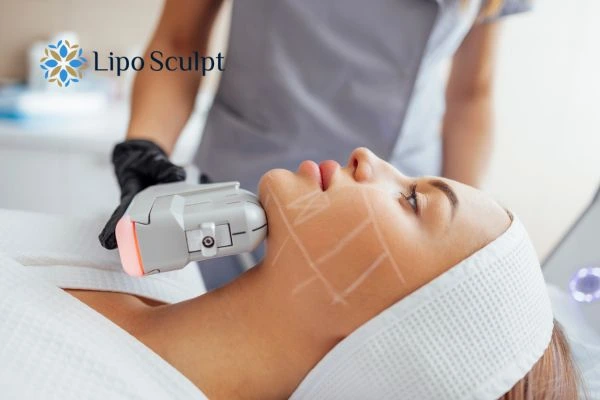 HIFU vs Botulinum Toxin: Understanding the Differences 1 HIFU vs Botox Rushden What is the best option for you?