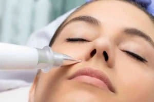 Best Actinic Keratoses Removal 3 Actinic keratoses Rushden solutions - book in today!