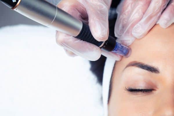 Explaining Total Skin Tightening Treatment and What to Expect 2 What Skin Concerns Can Total Skin Tightening Treatment Help With Rushden?